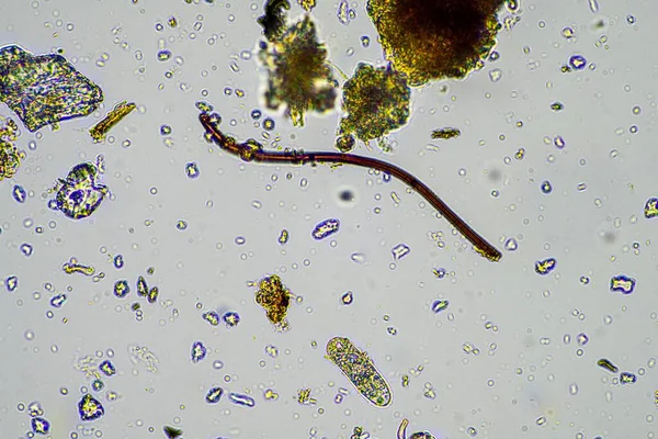 Microrganismos Solo Com Fungos Solo Hifas Crescendo Composto Uma Fazenda — Fotografia de Stock