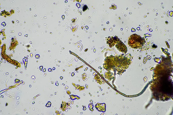 澳大利亚春天在土壤生物和微生物试验中 在显微镜下对土壤和堆肥中的真菌和真菌进行了大肆宣传 — 图库照片