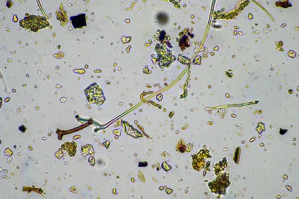 澳大利亚春天在土壤生物和微生物试验中 在显微镜下对土壤和堆肥中的真菌和真菌进行了大肆宣传 — 图库照片