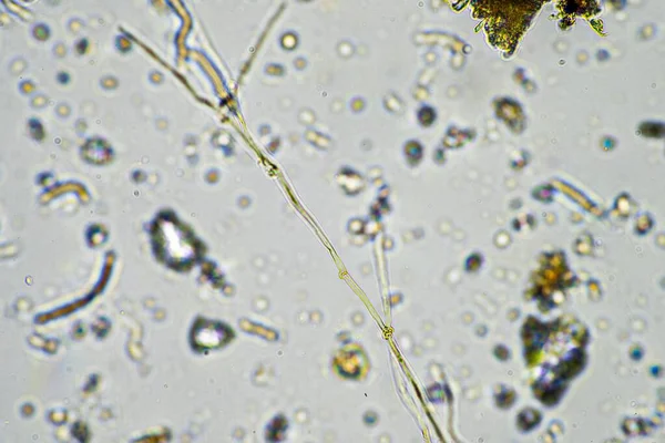 Μικροοργανισμοί Του Εδάφους Τους Μύκητες Του Εδάφους Αναπτύσσονται Στο Κομπόστ — Φωτογραφία Αρχείου