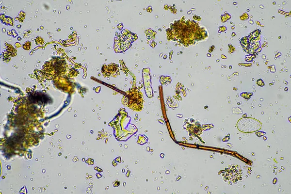 Microorganismos Del Suelo Con Hifas Hongos Del Suelo Creciendo Compost — Foto de Stock