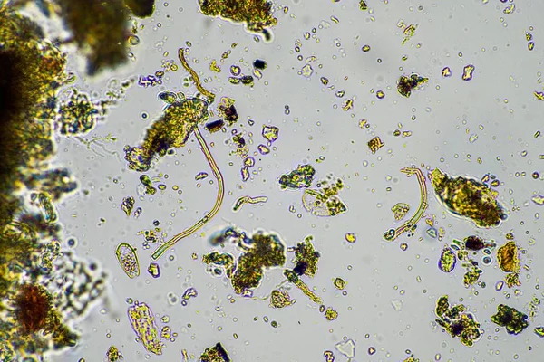 Mantar Mantar Hyphae Mikroskop Altında Toprak Gübre Toprak Biyolojisi Mikroorganizma — Stok fotoğraf