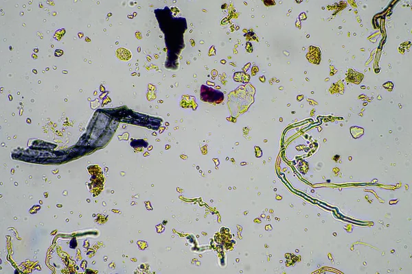 Грибковая Грибковая Гифы Микроскопом Почве Компосте Почвенной Биологии Микроорганизме Тест — стоковое фото