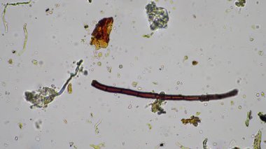 plant scientist working in agriculture, soil scientist studying soil microorganisms in america