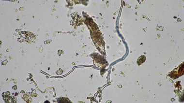 plant scientist working in agriculture, soil scientist studying soil microorganisms in america