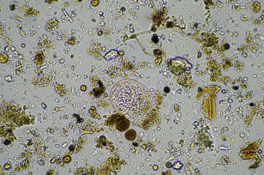 Hindistan 'da bir laboratuarda gübrelenmiş toprak mikropları.