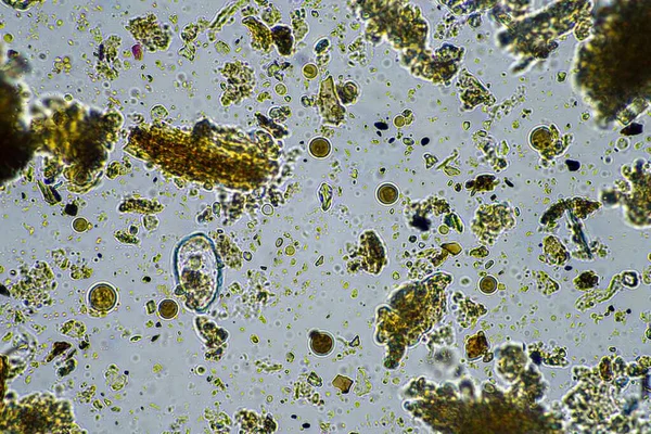 Микроскопический Червь Почве Австралии Компосте — стоковое фото