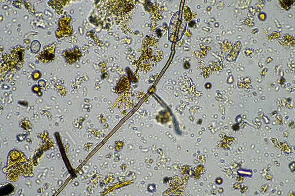 Микроскопический Червь Почве Австралии Компосте — стоковое фото