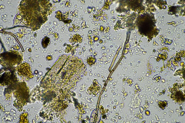 Avustralya Gübre Içinde Toprakta Mikroskobik Solucan — Stok fotoğraf