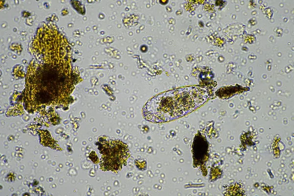 Human Parasites Human Gut Health — Stock Photo, Image
