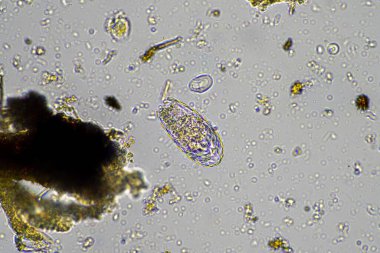 gübre yığınındaki toprak solucanları ve böcekler