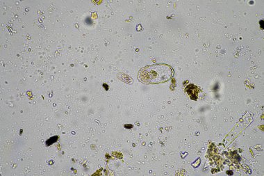 Avustralya 'da bir çiftlikteki topraktaki böcek paraziti.