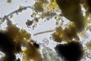 gübre yığınındaki toprak solucanları ve böcekler