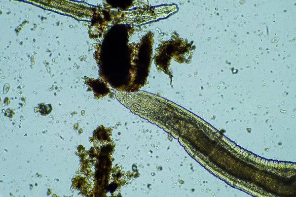 寄生虫だ 腸内感染症 病院での微生物感染は — ストック写真