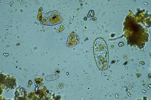 Menselijke Parasiet Darminfectieziekte Infectie Van Micro Organismen Het Ziekenhuis Bij — Stockfoto