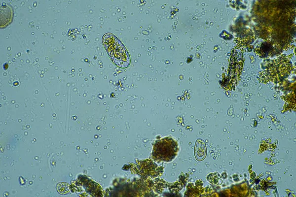 Human Parasites Human Gut Health — Stock Photo, Image