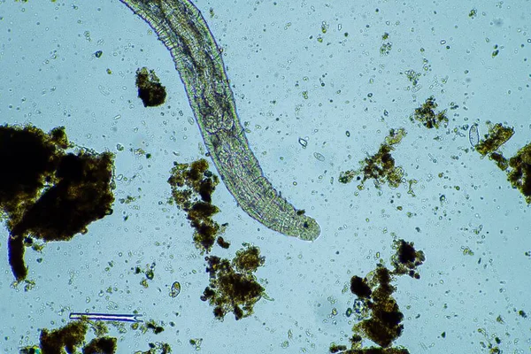 microscopic worm in the soil in australia in compost