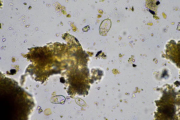 Menschlicher Parasit Darminfektionen Mikroorganismen Infektion Krankenhaus Bei Menschen — Stockfoto