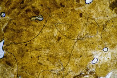 bebek dışkısı mikroskop altında bakteri ve böceklerle dolu bir laboratuvarda.