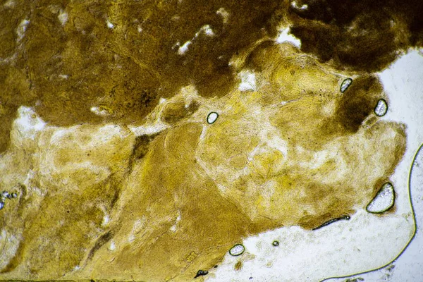 Детские Фекалии Микроскопом Смотрящие Какашки Бактериями Жуками Лаборатории — стоковое фото