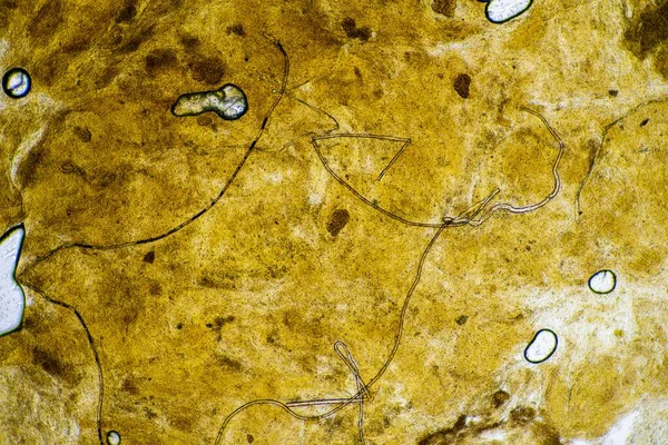 Odchody Niemowląt Pod Mikroskopem Patrząc Kupę Bakteriami Owadami Laboratorium — Zdjęcie stockowe