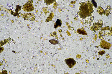 Toprak örnekleriyle bir toprak laboratuvarında çalışmak Avustralya 'da bir toprak testini test etmek.