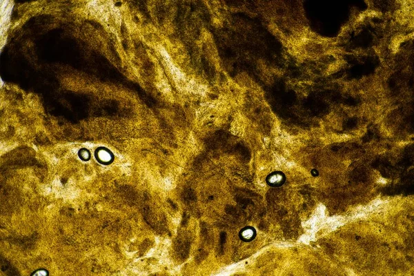 Baba Széklet Mikroszkóp Alatt Nézi Kakát Baktériumokkal Bogarakkal Egy Laboratóriumban — Stock Fotó