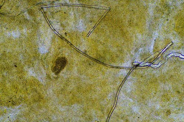 Heces Del Bebé Bajo Microscopio Mirando Caca Con Bacterias Insectos —  Fotos de Stock