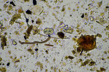 toprak örneğindeki toprak mikroorganizmaları, toprak mantarı ve bakteriler gübreleme çiftliğindeki rejeneratif çiftlikte. Toprak testinde mantar hyphae. Avusturalya 'da