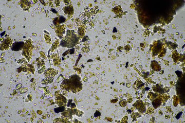 toprak örneğindeki toprak mikroorganizmaları, toprak mantarı ve bakteriler gübreleme çiftliğindeki rejeneratif çiftlikte. Toprak testinde mantar hyphae. Avusturalya 'da