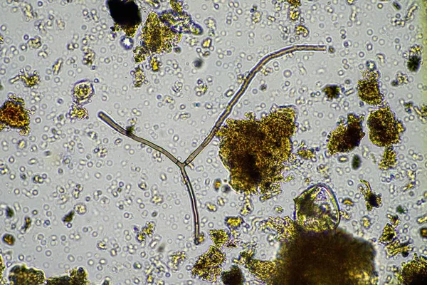 soil microorganisms in a soil sample, soil fungus and bacteria on a regenerative farm in compost. fungi hyphae in a soil test. in australia