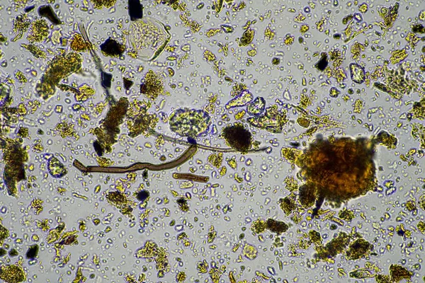 soil microorganisms in a soil sample, soil fungus and bacteria on a regenerative farm in compost. fungi hyphae in a soil test. in australia