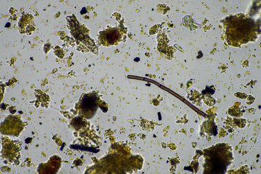 toprak örneğindeki toprak mikroorganizmaları, toprak mantarı ve bakteriler gübreleme çiftliğindeki rejeneratif çiftlikte. Toprak testinde mantar hyphae. Avusturalya 'da