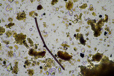 toprak örneğindeki toprak mikroorganizmaları, toprak mantarı ve bakteriler gübreleme çiftliğindeki rejeneratif çiftlikte. Toprak testinde mantar hyphae. Avusturalya 'da
