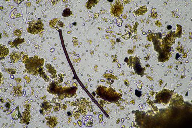 soil microorganisms in a soil sample, soil fungus and bacteria on a regenerative farm in compost. fungi hyphae in a soil test. in australia clipart