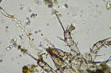 soil microorganisms including nematode, microarthropods, micro arthropod, tardigrade, and rotifers a soil sample, soil fungus and bacteria on a regenerative farm in compost under the microscope in australia