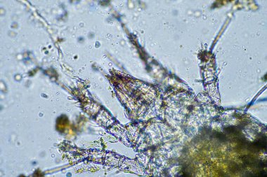 soil microorganisms including nematode, microarthropods, micro arthropod, tardigrade, and rotifers a soil sample, soil fungus and bacteria on a regenerative farm in compost under the microscope in australia