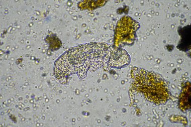 soil microorganisms including nematode, microarthropods, micro arthropod, tardigrade, and rotifers a soil sample, soil fungus and bacteria on a regenerative farm in compost under the microscope in australia clipart