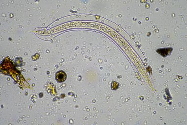 soil microorganisms including nematode, microarthropods, micro arthropod, tardigrade, and rotifers a soil sample, soil fungus and bacteria on a regenerative farm in compost under the microscope in australia