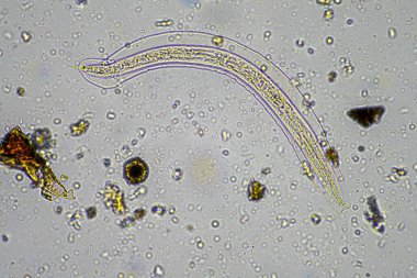 soil microorganisms including nematode, microarthropods, micro arthropod, tardigrade, and rotifers a soil sample, soil fungus and bacteria on a regenerative farm in compost under the microscope in australia