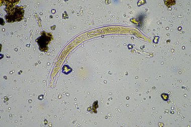 soil microorganisms including nematode, microarthropods, micro arthropod, tardigrade, and rotifers a soil sample, soil fungus and bacteria on a regenerative farm in compost under the microscope in australia