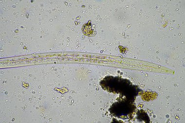 soil microorganisms including nematode, microarthropods, micro arthropod, tardigrade, and rotifers a soil sample, soil fungus and bacteria on a regenerative farm in compost under the microscope in australia