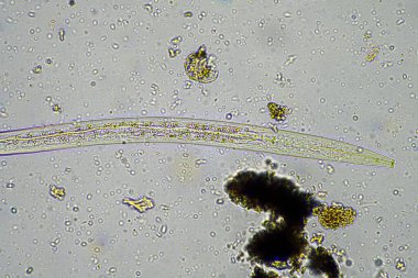 soil microorganisms including nematode, microarthropods, micro arthropod, tardigrade, and rotifers a soil sample, soil fungus and bacteria on a regenerative farm in compost under the microscope in australia