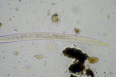 soil microorganisms including nematode, microarthropods, micro arthropod, tardigrade, and rotifers a soil sample, soil fungus and bacteria on a regenerative farm in compost under the microscope in australia