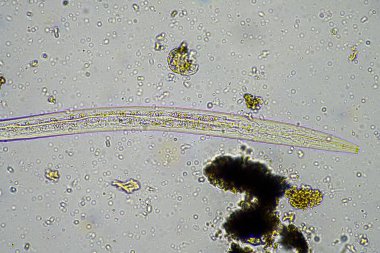 soil microorganisms including nematode, microarthropods, micro arthropod, tardigrade, and rotifers a soil sample, soil fungus and bacteria on a regenerative farm in compost under the microscope in australia