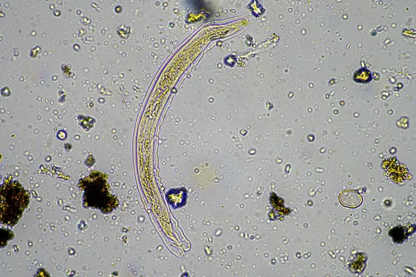 マイクロ節足動物 マイクロ節足動物 タージグレードなどの土壌微生物及びオーストラリアの顕微鏡下の堆肥の再生農場の土壌サンプル 土壌真菌及び細菌 — ストック写真