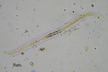 Toprak mikroorganizmaları, nematod, mikro eklem bacaklılar, eklem bacaklılar, tardigrad ve kemirgenler bir toprak örneği, toprak mantarı ve bakterileri mikroskop altında bir rejeneratif çiftlikteki toprak mantarı ve bakterileri de kapsıyor. Avusturalya 'da