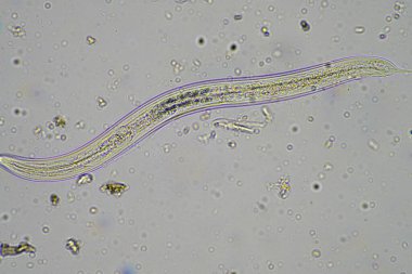 Hindistan 'da bir çiftlikteki gübrenin içindeki toprak mikropları
