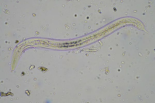 Mikroorganismer Och Markbiologi Med Nematoder Och Svampar Mikroskop Ett Jordkompostprov — Stockfoto