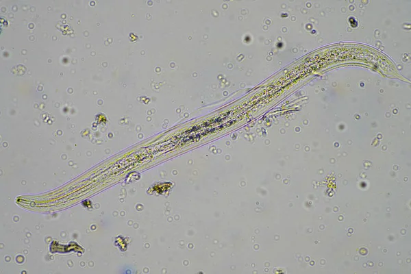 stock image microorganisms and soil biology, with nematodes and fungi under the microscope. in a soil and compost sample in australia